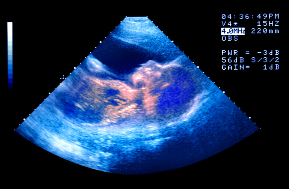 ultrasound .jpeg